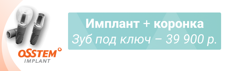 Зуб под ключ! Имплант Osstem + коронка — всего 39 900 р.