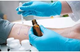 Аллерголог