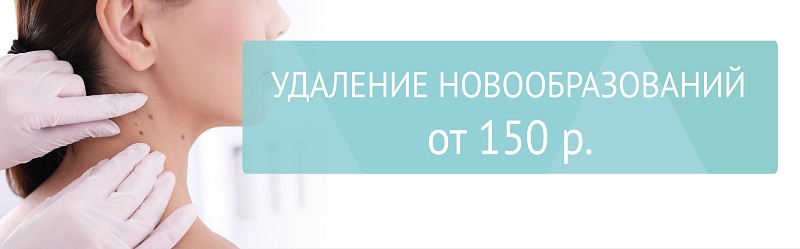 Удаление новообразований по выгодной цене