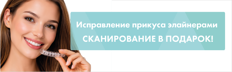 Исправление прикуса: элайнеры + сканирование в подарок!