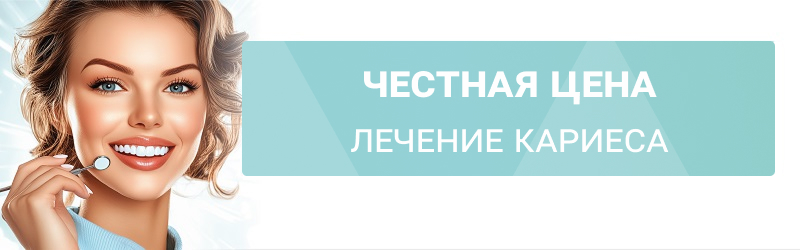 Честная цена: Лечение кариеса от 3200 р.