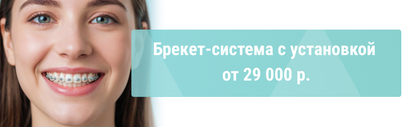 Антикризисные цены  на брекеты – от 29 000р.